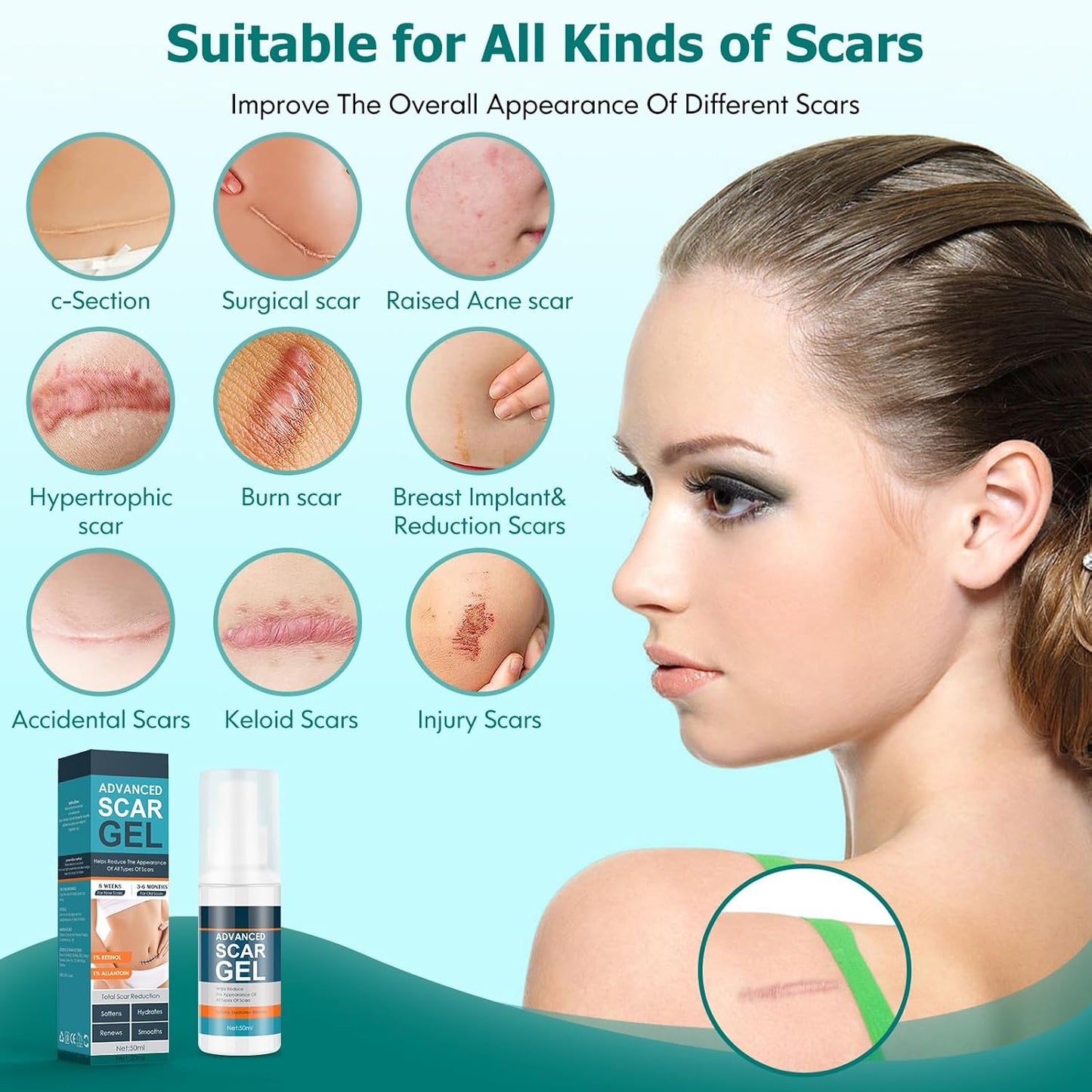 Gel para cicatrices