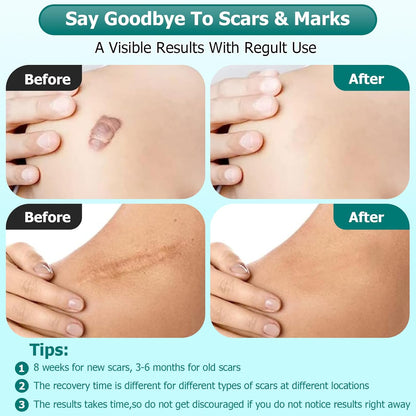 Gel para cicatrices