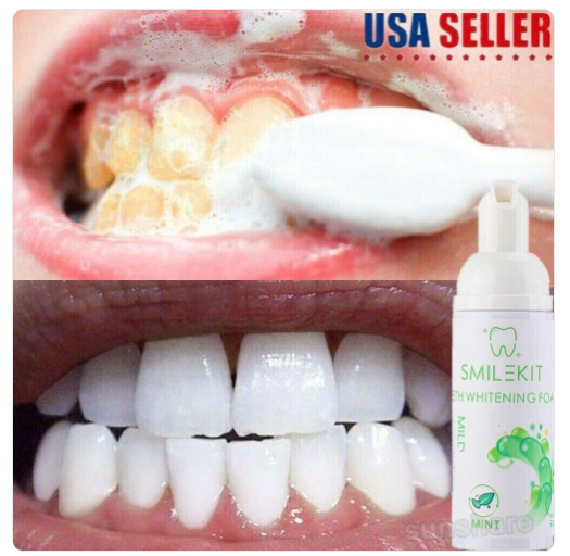Producto identificado: SMILE KIT - Teeth Whitening Foam